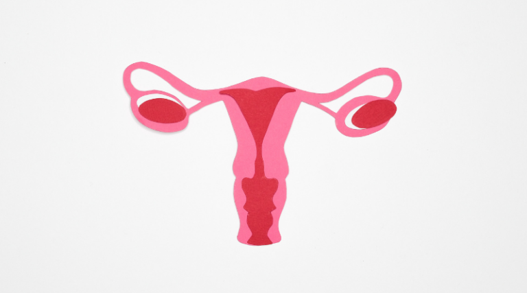 What’s Polycystic Ovary Syndrome?