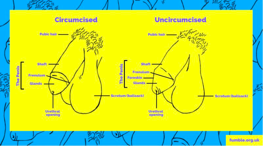 diagram of circumcised and uncircumcised penis